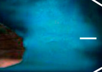 Como sobrevivir a las adicciones