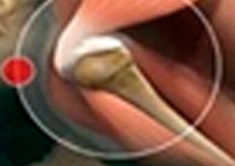 La enfermedad como mensaje del alma